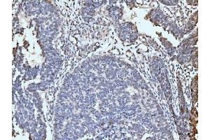 IHC analysis of ARL6IP6 using anti-ARL6IP6 antibody (ABIN7603020). (ARL6IP6 抗体  (Middle Region))