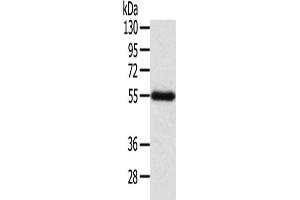 Gel: 8 % SDS-PAGE, Lysate: 60 μg, Lane: Human placenta tissue, Primary antibody: ABIN7192312(SEPN1 Antibody) at dilution 1/200, Secondary antibody: Goat anti rabbit IgG at 1/8000 dilution, Exposure time: 2 minutes (Selenoprotein N 抗体)