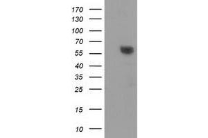 HEK293T cells were transfected with the pCMV6-ENTRY control (Left lane) or pCMV6-ENTRY DTNA (Right lane) cDNA for 48 hrs and lysed. (DTNA 抗体)