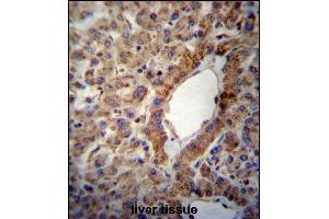 ACSS2 Antibody (Center) (ABIN657155 and ABIN2846289) immunohistochemistry analysis in formalin fixed and paraffin embedded human liver tissue followed by peroxidase conjugation of the secondary antibody and DAB staining. (ACSS2 抗体  (AA 261-290))