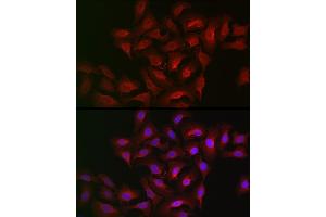 Immunofluorescence analysis of U2OS cells using B Rabbit pAb (ABIN6129899, ABIN6136816, ABIN6136817 and ABIN6222589) at dilution of 1:100 (40x lens). (ALOX15B 抗体  (AA 1-200))