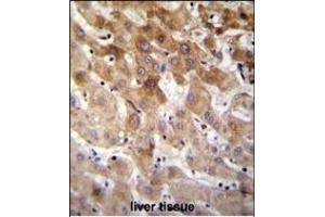 MBTD1 Antibody (C-term) (ABIN655319 and ABIN2844896) immunohistochemistry analysis in formalin fixed and paraffin embedded human liver tissue followed by peroxidase conjugation of the secondary antibody and DAB staining. (MBTD1 抗体  (C-Term))