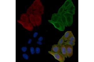 ABIN6262776 and ABIN6266570 staining Hela cells(24h of starvation treatment) by IF/ICC. (KRT17 抗体  (C-Term))