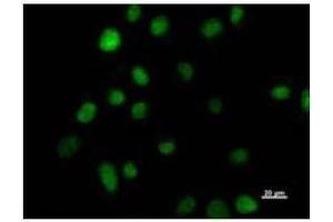 Immunostaining analysis in HeLa cells. (HOXC9 抗体)