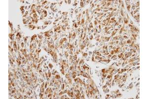 IHC-P Image Immunohistochemical analysis of paraffin-embedded U87 xenograft, using EEF1B2, antibody at 1:250 dilution.