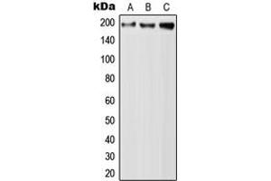 Western blot analysis of QSER1 expression in A549 (A), Raw264. (QSER1 抗体  (Center))