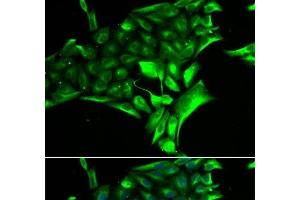 Immunofluorescence analysis of MCF-7 cells using PYGB Polyclonal Antibody (PYGB 抗体)