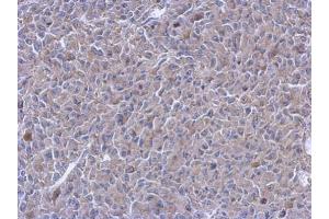 Immunohistochemistry (IHC) image for anti-Protein Tyrosine Phosphatase G1 (PTPN12) (N-Term) antibody (ABIN2855422)