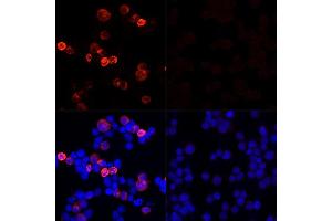 Immunofluorescence analysis of 293T cells transfected with SARS-CoV-2 Spike protein and untreated 293T cells use SARS-CoV-2 Spike Rabbit pAb (ABIN7266506) at dilution of 1:100 (40x lens). (Coronavirus Spike Glycoprotein 抗体)