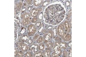 Immunohistochemical staining of human kidney with EXOC8 polyclonal antibody  shows moderate cytoplasmic and membranous positivity in tubular cells at 1:200-1:500 dilution.
