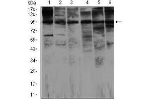 Western blot analysis using NOS2 mouse mAb against Jurkat (1), Jurkat (2), A549 (3), HeLa (4), NIH3T3 (5)and MCF-7 (6) cell lysate.