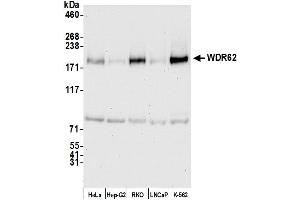 anti-WD Repeat Domain 62 (WDR62) (AA 900-950) antibody