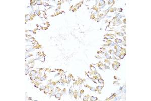 Immunohistochemistry (IHC) image for anti-DnaJ (Hsp40) Homolog, Subfamily B, Member 11 (DNAJB11) (AA 89-358) antibody (ABIN6139703)