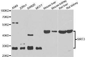 Western blot analysis of extracts of various cell lines, using SIRT3 antibody (ABIN5974409) at 1/1000 dilution. (SIRT3 抗体)