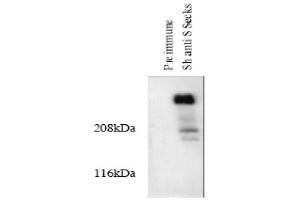 Image no. 1 for anti-A Kinase (PRKA) Anchor Protein 12 (AKAP12) (AA 620-1596) antibody (ABIN264964) (AKAP12 抗体  (AA 620-1596))