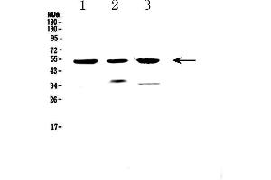 Western blot analysis of HTRA1 using anti-HTRA1 antibody . (HTRA1 抗体)