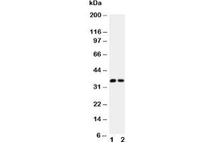 Western blot testing of Calbindin antibody (0. (CALB1 抗体  (AA 2-175))