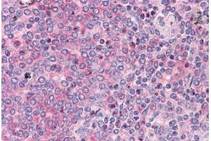 Human Spleen: Formalin-Fixed, Paraffin-Embedded (FFPE) (ADAM17 抗体  (AA 215-315))