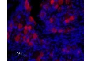 Immunohistochemistry (IHC) image for anti-Transient Receptor Potential Cation Channel, Subfamily V, Member 1 (TRPV1) (AA 605-619), (C616S), (Extracellular) antibody (ABIN7043838)