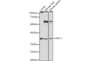 Western blot analysis of extracts of various cell lines, using PHF11 antibody (ABIN6128438, ABIN6145534, ABIN6145536 and ABIN6223765) at 1:1000 dilution. (PHF11 抗体  (AA 1-292))