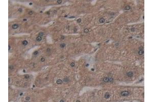 Detection of AATK in Human Liver Tissue using Polyclonal Antibody to Apoptosis Associated Tyrosine Kinase (AATK) (AATK 抗体  (AA 1216-1374))