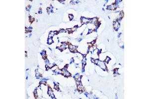 Immunohistochemistry (IHC) image for anti-Cystathionine-beta-Synthase (CBS) antibody (ABIN7266615)