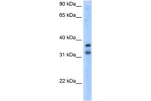 Western Blotting (WB) image for anti-Potassium Channel Regulator (KCNRG) antibody (ABIN2461173) (KCNRG 抗体)