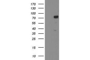 Western Blotting (WB) image for anti-Katanin P80 (WD Repeat Containing) Subunit B 1 (KATNB1) antibody (ABIN1498987) (KATNB1 抗体)