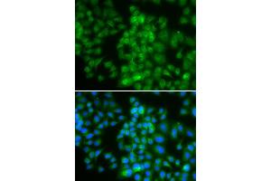 Immunofluorescence analysis of HeLa cell using LMO4 antibody. (LMO4 抗体)