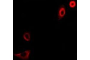 Immunofluorescent analysis of CD66f staining in A549 cells. (PSG1 抗体)