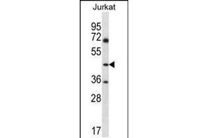 Western blot analysis in Jurkat cell line lysates (35ug/lane). (ASS1 抗体  (C-Term))