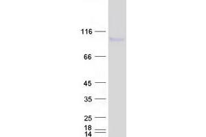 Validation with Western Blot