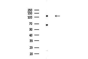 Western blot analysis of lysates from Hela cells(starvation,24h treatment), using Collagen VI alpha 2 Antibody at 1/1000 dilution.