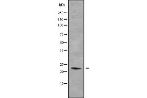 Western blot analysis of DUX5 using HeLa whole cell lysates (DUX5 抗体  (N-Term))