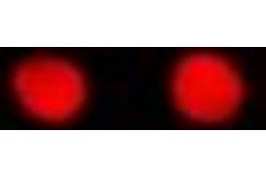 Immunofluorescent analysis of RbAp48 staining in MCF7 cells. (Retinoblastoma Binding Protein 4 抗体)