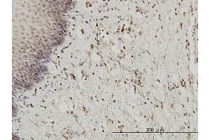 Immunoperoxidase of monoclonal antibody to HYI on formalin-fixed paraffin-embedded human esophagus. (HYI 抗体  (AA 1-217))