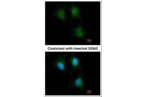 ICC/IF Image Immunofluorescence analysis of methanol-fixed HeLa, using IFITM1, antibody at 1:500 dilution. (IFITM1 抗体)