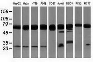 Image no. 3 for anti-Pseudouridylate Synthase 7 Homolog (PUS7) antibody (ABIN1500514) (PUS7 抗体)