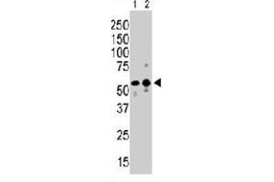 Western blot analysis of PI4K2B polyclonal antibody  in mouse brain tissue (Lane A) and Saos-2 (Lane B) cell lysates. (PI4K2B 抗体  (C-Term))