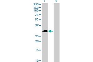 Western Blot analysis of SLA expression in transfected 293T cell line by SLA MaxPab polyclonal antibody. (SLA 抗体  (AA 1-276))