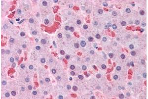 Human Liver: Formalin-Fixed, Paraffin-Embedded (FFPE) (Hemoglobin Subunit beta 抗体  (AA 38-148))