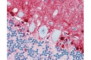 Immunohistochemical analysis of paraffin-embedded human brain, cerebellun using S100B mouse mAb with DAB staining. (S100B 抗体)