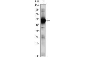 Western blot analysis using RAG2 mouse mAb against RAG2(AA: 350-527)-hIgGFc transfected HEK293 (1)cell lysate. (RAG2 抗体  (AA 350-527))