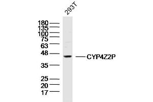 293T lysates probed with CYP4Z2P Polyclonal Antibody, Unconjugated  at 1:300 dilution and 4˚C overnight incubation. (CYP4Z2P 抗体  (AA 51-150))