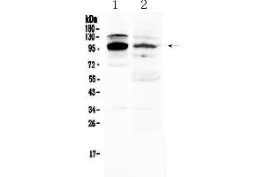 Western blot analysis of NFAT2 using anti-NFAT2 antibody . (NFATC1 抗体  (AA 589-652))