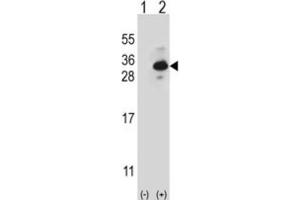 Western Blotting (WB) image for anti-Clathrin, Light Chain B (CLTB) antibody (ABIN2997028) (CLTB 抗体)