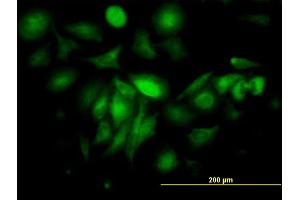 Immunofluorescence of monoclonal antibody to FTL on HeLa cell. (FTL 抗体  (AA 1-175))