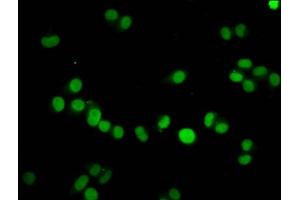 Immunofluorescence (IF) image for anti-Histone Cluster 1, H4a (HIST1H4A) (meLys59) antibody (ABIN7139605)