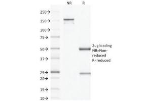 SDS-PAGE Analysis of Purified, BSA-Free Factor XIIIa Antibody (clone F13A1/1683). (F13A1 抗体  (AA 46-181))