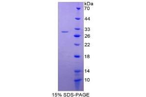 SDS-PAGE (SDS) image for Glutathione S-Transferase alpha 4 (GSTA4) (AA 2-222) protein (His tag) (ABIN2125002)